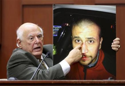 Expert bolsters Zimmerman account of Trayvon Martin shooting