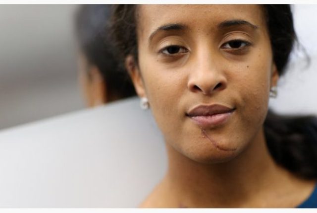 Story of Canadian ‘MUA’ Student stabbed in Nevis, makes headlines in the Toronto Star