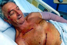Canadian man shot nine times in Dominican Republic recovering
