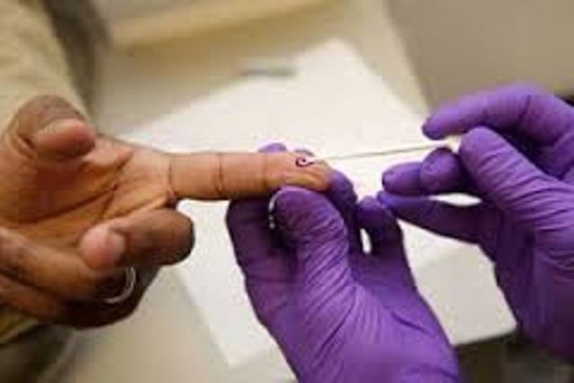 Ministry of Health on Verge of Rapid HIV Testing