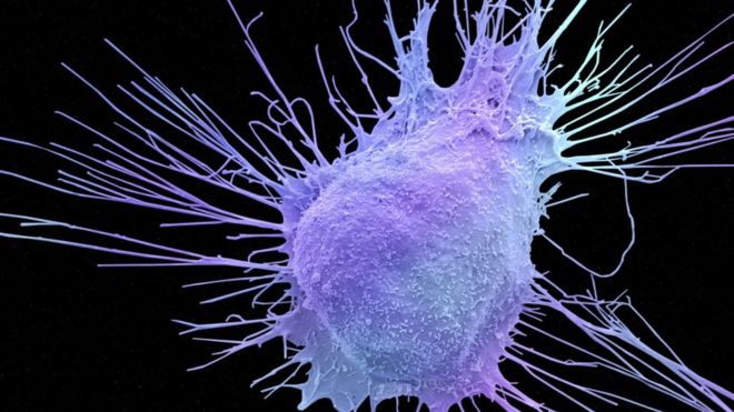 ‘Milestone’ prostate cancer drug
