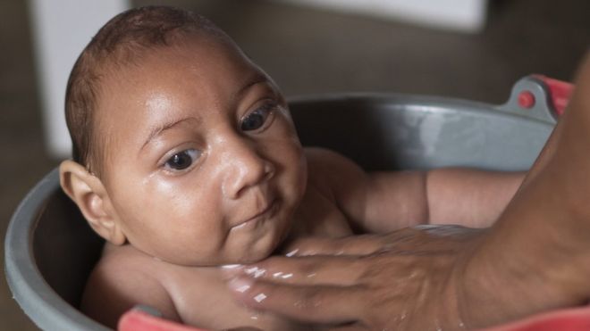Zika virus: Outbreak ‘likely to spread across Americas’ says WHO
