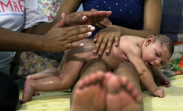 Health Officials Confirm Zika Virus Causes Birth Defects