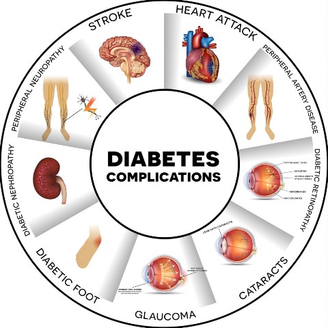 St. Kitts Diabetes Association Commended On United Nations International Observance of World Diabetes Day 2016