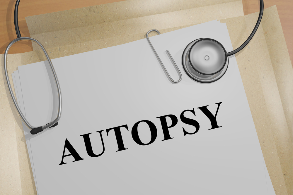 Autopsy Performed on The Body Of James Shuford Jr.