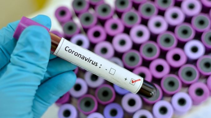 St. Kitts And Nevis Records One (1) Additional Case Of COVID-19 On January 7, 2021