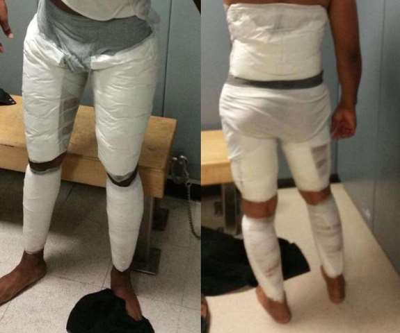 St. Kitts Man Who Strapped Cocaine to His Leg Prior To Airline Flight Gets 4 Years