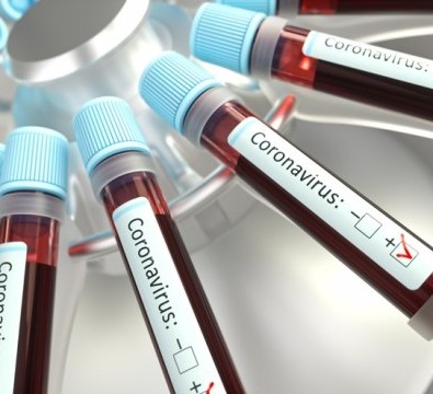 St Kitts and Nevis reports two new COVID-19 cases