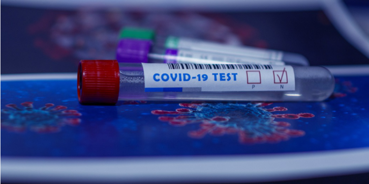 All 19 Confirmed Cases of COVID-19 In St. Kitts & Nevis Recovered