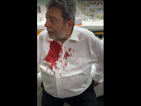 Prime Minister sustains head injury during protests