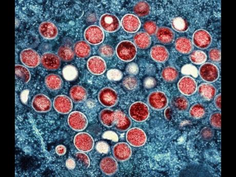 WHO renames monkeypox as ‘Mpox’, citing racism concerns