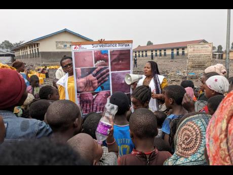 Mpox Outbreaks Declared Global Health Emergency