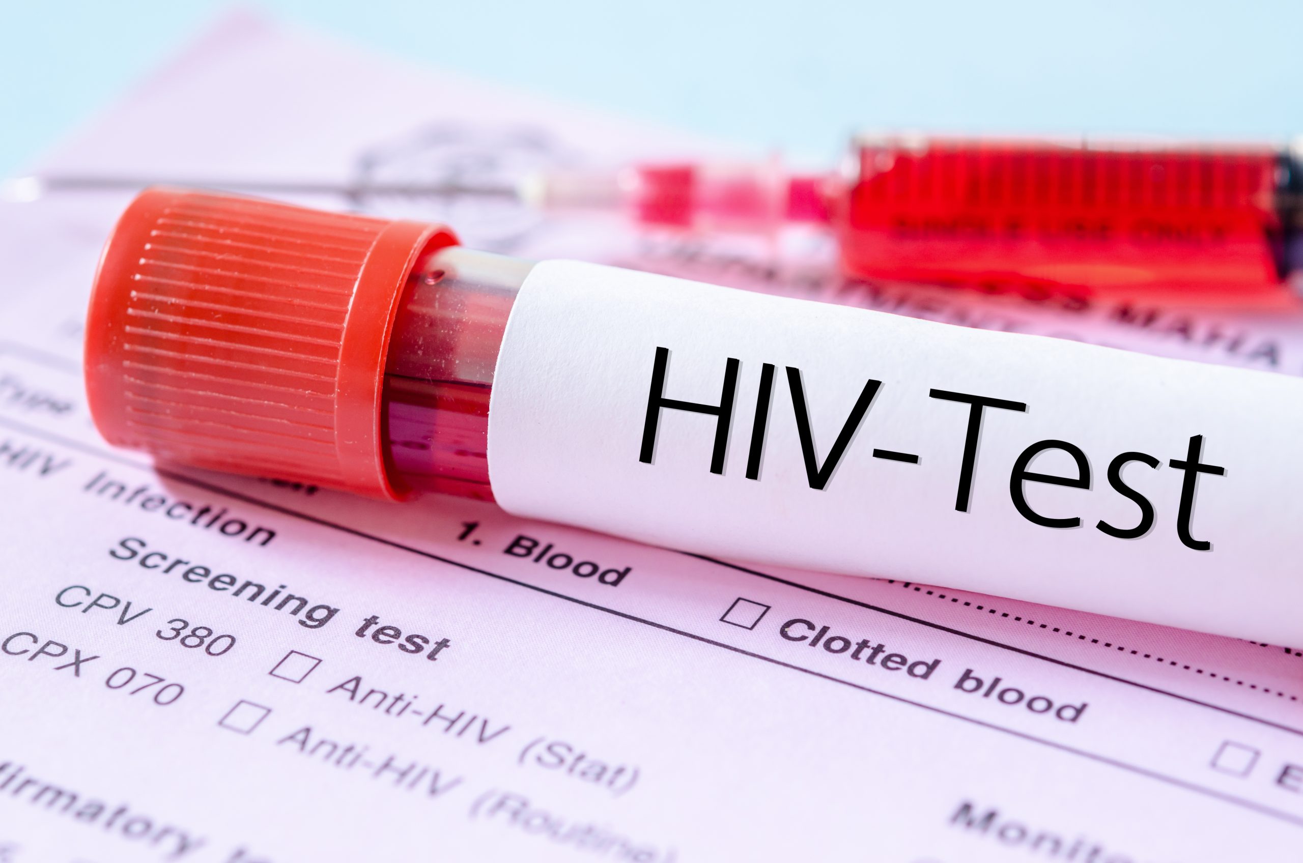 Nevis Reports Decrease in Annual HIV Incidence, Strengthens Prevention and Care Efforts